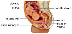 Retrofleksirana uklještenja gravidna materica